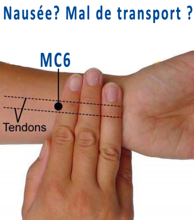 La nausée, le mal de transport ?